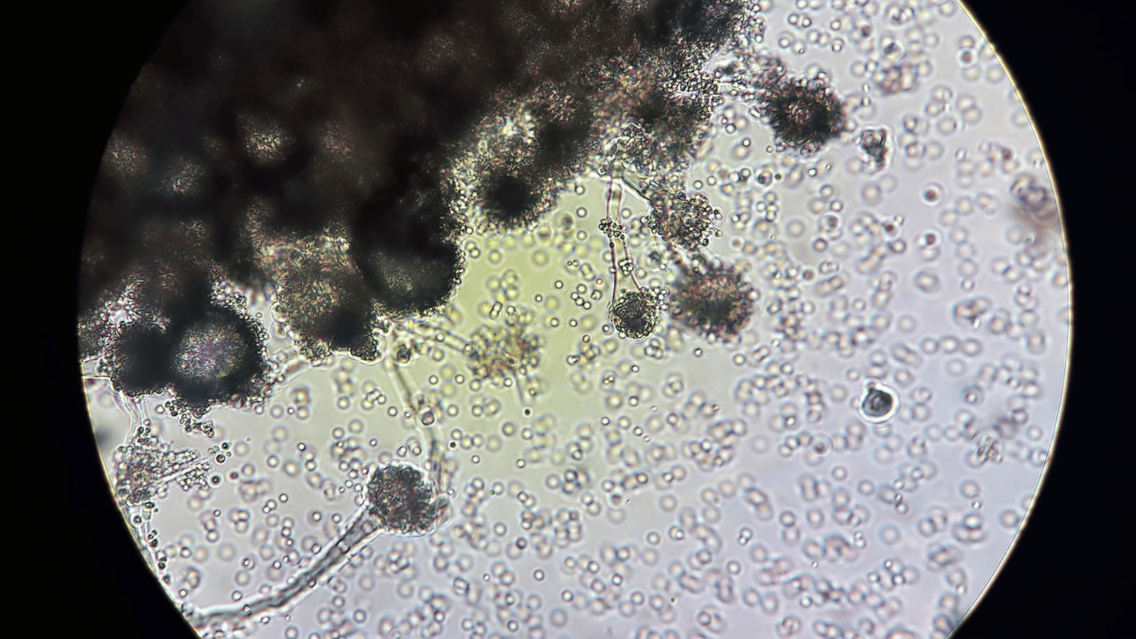 Fungi under a microscope